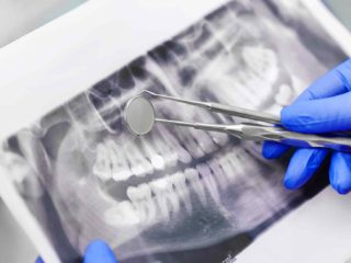 Royal Dental Stúdió Fogászat - Röntgen - Kapcsolat